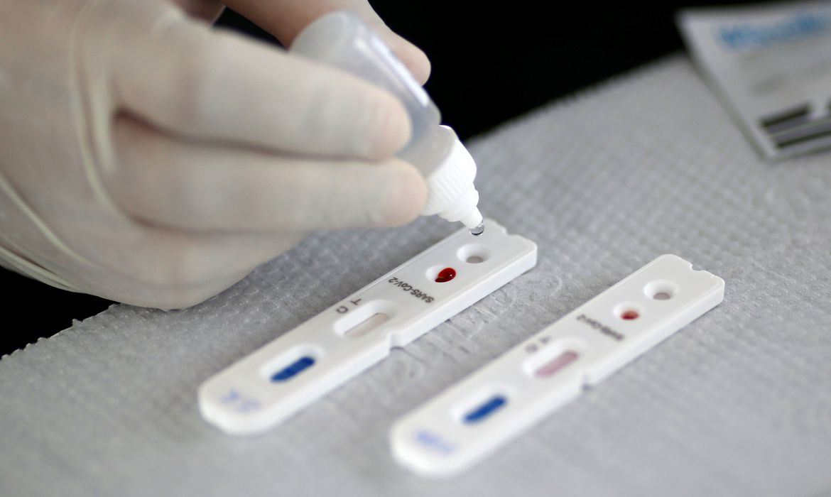 testes rápidos para detectar coronavírus